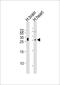 Charged Multivesicular Body Protein 3 antibody, PA5-49400, Invitrogen Antibodies, Western Blot image 