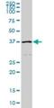 Homeostatic Iron Regulator antibody, H00003077-M01, Novus Biologicals, Western Blot image 