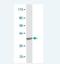 ACO1 antibody, H00000048-M02, Novus Biologicals, Western Blot image 