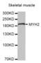 Myosin Heavy Chain 2 antibody, abx002613, Abbexa, Western Blot image 