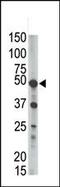 Phosphatidylinositol Glycan Anchor Biosynthesis Class K antibody, 61-397, ProSci, Western Blot image 