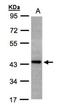 ST3 Beta-Galactoside Alpha-2,3-Sialyltransferase 2 antibody, NBP1-32451, Novus Biologicals, Western Blot image 