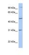 Protein Phosphatase, Mg2+/Mn2+ Dependent 1J antibody, orb325935, Biorbyt, Western Blot image 
