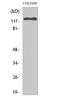 EPH Receptor B6 antibody, STJ92953, St John