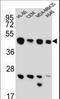 Bridging Integrator 2 antibody, LS-C156818, Lifespan Biosciences, Western Blot image 