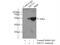 Keratin 15 antibody, 10137-1-AP, Proteintech Group, Immunoprecipitation image 