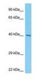 Intersectin 2 antibody, orb326543, Biorbyt, Western Blot image 