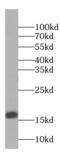 Protein Phosphatase 1 Regulatory Inhibitor Subunit 14A antibody, FNab01919, FineTest, Western Blot image 