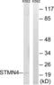 Stathmin 4 antibody, LS-B9876, Lifespan Biosciences, Western Blot image 