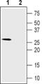 Calcium Voltage-Gated Channel Auxiliary Subunit Gamma 6 antibody, PA5-77348, Invitrogen Antibodies, Western Blot image 