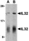 Interleukin 32 antibody, MBS150483, MyBioSource, Western Blot image 