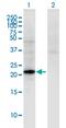 Choriogonadotropin subunit beta antibody, MA5-22884, Invitrogen Antibodies, Western Blot image 