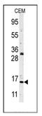 Histone H3 antibody, AP11070PU-N, Origene, Western Blot image 