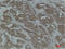 Calnexin antibody, STJ97441, St John