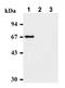 Checkpoint Kinase 2 antibody, ADI-KAM-CC112-E, Enzo Life Sciences, Western Blot image 