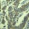Myristoylated Alanine Rich Protein Kinase C Substrate antibody, orb15008, Biorbyt, Immunohistochemistry paraffin image 