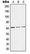 Glycerol Kinase 2 antibody, MBS820572, MyBioSource, Western Blot image 