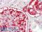 S100 Calcium Binding Protein A6 antibody, LS-B12316, Lifespan Biosciences, Immunohistochemistry paraffin image 