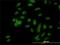 Ubiquitin Protein Ligase E3A antibody, H00007337-M01, Novus Biologicals, Immunocytochemistry image 