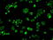 Cytochrome P450 Oxidoreductase antibody, GTX83859, GeneTex, Immunofluorescence image 