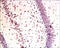 Tumor Associated Calcium Signal Transducer 2 antibody, 251611, Abbiotec, Immunohistochemistry paraffin image 