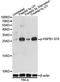 Heat Shock Protein Family B (Small) Member 1 antibody, STJ22181, St John
