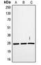 TNF Superfamily Member 12 antibody, LS-C353096, Lifespan Biosciences, Western Blot image 