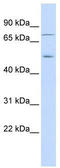 Eukaryotic Translation Initiation Factor 2 Alpha Kinase 1 antibody, TA344094, Origene, Western Blot image 