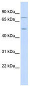 Eukaryotic Translation Initiation Factor 2 Alpha Kinase 1 antibody, TA344094, Origene, Western Blot image 