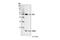 Integrin Linked Kinase antibody, 3862S, Cell Signaling Technology, Western Blot image 