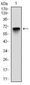 Glucose-6-Phosphate Dehydrogenase antibody, AM06697SU-N, Origene, Western Blot image 