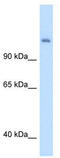 Carbamoyl-Phosphate Synthase 1 antibody, TA338263, Origene, Western Blot image 