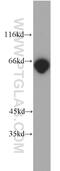 p65 antibody, 10745-1-AP, Proteintech Group, Western Blot image 