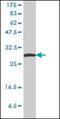 Stratifin antibody, orb89603, Biorbyt, Western Blot image 