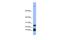 Hepcidin Antimicrobial Peptide antibody, PA5-42038, Invitrogen Antibodies, Western Blot image 
