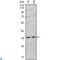 Protein Phosphatase 1 Catalytic Subunit Alpha antibody, LS-C814032, Lifespan Biosciences, Western Blot image 