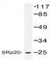 Serine And Arginine Rich Splicing Factor 3 antibody, AP01175PU-N, Origene, Western Blot image 