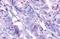 Adhesion G Protein-Coupled Receptor A2 antibody, NLS2167, Novus Biologicals, Immunohistochemistry paraffin image 