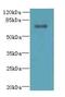 Tetratricopeptide Repeat Domain 30A antibody, A65994-100, Epigentek, Western Blot image 