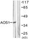 SUMO1 Activating Enzyme Subunit 1 antibody, LS-C118599, Lifespan Biosciences, Western Blot image 