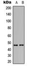 Arginine Vasopressin Receptor 1B antibody, LS-C358922, Lifespan Biosciences, Western Blot image 