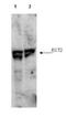 Epithelial Cell Transforming 2 antibody, orb345551, Biorbyt, Western Blot image 