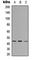 SPT3 Homolog, SAGA And STAGA Complex Component antibody, abx121766, Abbexa, Western Blot image 