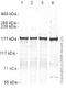 Clathrin Heavy Chain Like 1 antibody, ab21679, Abcam, Western Blot image 