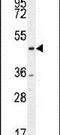 C-Terminal Binding Protein 1 antibody, PA5-24409, Invitrogen Antibodies, Western Blot image 