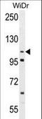 ADAM Metallopeptidase Domain 19 antibody, LS-C156038, Lifespan Biosciences, Western Blot image 