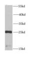 Cysteine And Glycine Rich Protein 3 antibody, FNab02031, FineTest, Western Blot image 