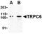 Transient Receptor Potential Cation Channel Subfamily C Member 6 antibody, orb74751, Biorbyt, Western Blot image 