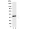 Kallikrein Related Peptidase 9 antibody, R30918, NSJ Bioreagents, Western Blot image 