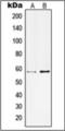 Potassium Voltage-Gated Channel Subfamily C Member 1 antibody, orb376090, Biorbyt, Western Blot image 